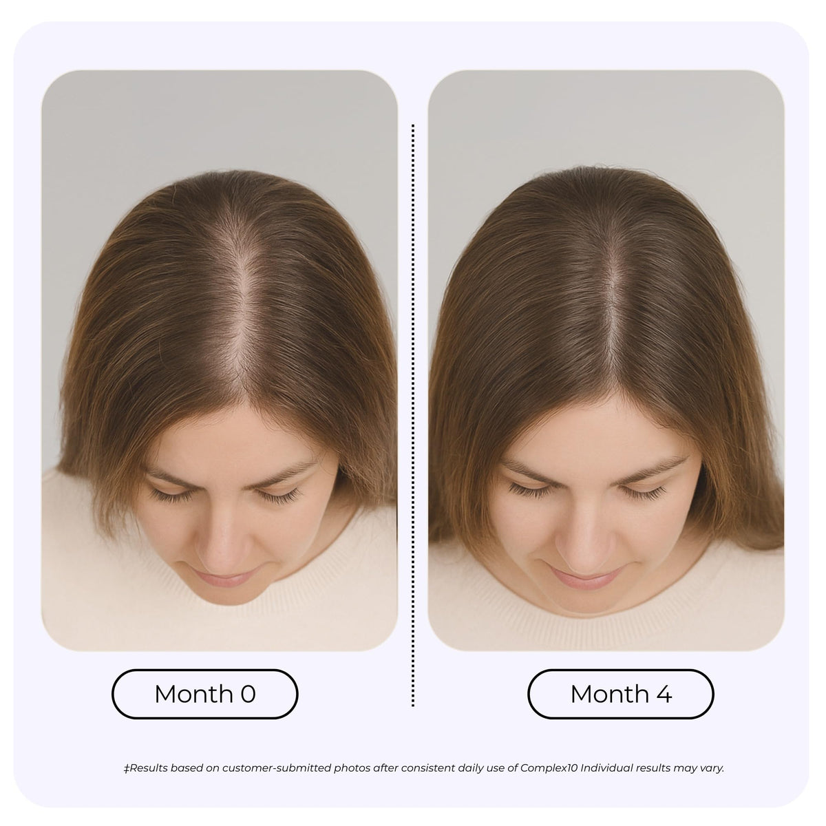 Biotin Collagen Hair Support Supplement 30 Capsules Q962